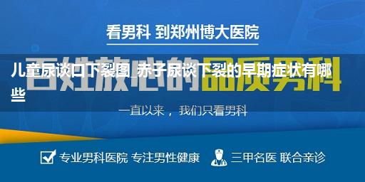 儿童尿谈口下裂图_赤子尿谈下裂的早期症状有哪些